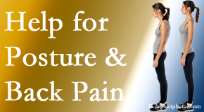 Poor posture and back pain are linked and find help and relief at Medical Spine and Sports Injury and Rehab Centers.
