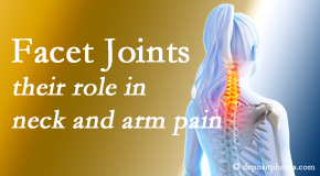 Medical Spine and Sports Injury and Rehab Centers thoroughly examines, diagnoses, and treats cervical spine facet joints for neck pain relief when they are involved.