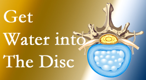 Medical Spine and Sports Injury and Rehab Centers uses spinal manipulation and exercise to boost the diffusion of water into the disc which helps the health of the disc.