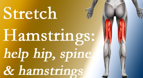 Medical Spine and Sports Injury and Rehab Centers encourages back pain patients to stretch hamstrings for length, range of motion and flexibility to support the spine.