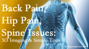Medical Spine and Sports Injury and Rehab Centers examines back pain patients for a variety of issues like back pain and hip pain and other spine issues with imaging and clinical tests that influence a relieving chiropractic treatment plan.