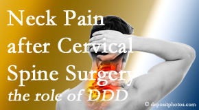Medical Spine and Sports Injury and Rehab Centers offers gentle treatment for neck pain after neck surgery.