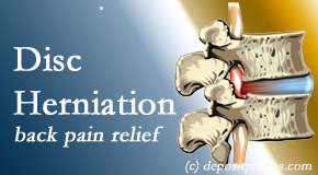 Medical Spine and Sports Injury and Rehab Centers offers non-surgical treatment for relief of disc herniation related back pain. 