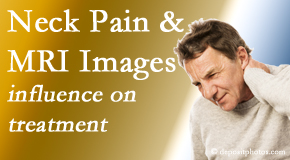 Medical Spine and Sports Injury and Rehab Centers considers MRI findings like Modic Changes when setting up a neck pain relieving treatment plan.