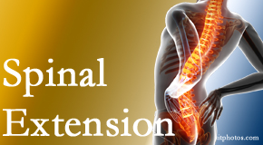 Medical Spine and Sports Injury and Rehab Centers knows the role of extension in spinal motion, its necessity, its benefits and potential harmful effects. 