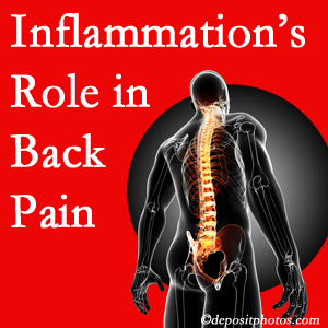 The role of inflammation in Baton Rouge back pain is real. Chiropractic care can manage it.