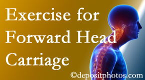 Baton Rouge chiropractic treatment of forward head carriage is two-fold: manipulation and exercise.