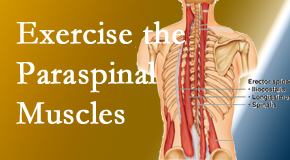 Medical Spine and Sports Injury and Rehab Centers explains the importance of paraspinal muscles and their strength for Baton Rouge back pain relief.