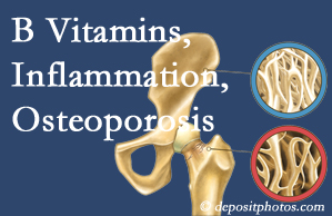 Baton Rouge chiropractic care of osteoporosis usually comes with nutritional tips like b vitamins for inflammation reduction and for prevention.