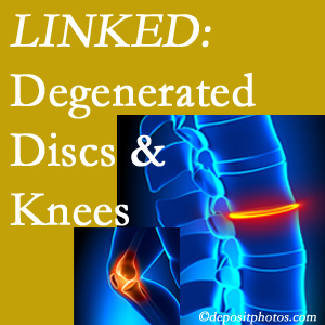 Degenerated discs and degenerated knees are not such strange bedfellows. They are seen to be related. Baton Rouge patients with a loss of disc height due to disc degeneration often also have knee pain related to degeneration. 