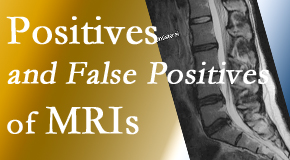 Medical Spine and Sports Injury and Rehab Centers carefully decides when and if MRI images are needed to guide the Baton Rouge chiropractic treatment plan. 
