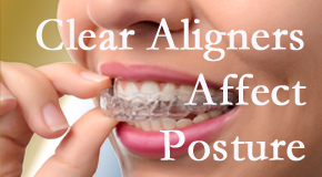 Clear aligners influence posture which Baton Rouge chiropractic helps.