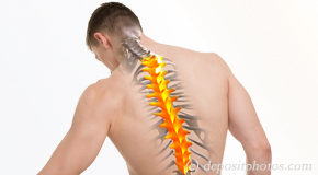 Baton Rouge  thoracic spine pain image 