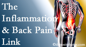 Spine & Sports Rehab Center tackles the inflammatory process that accompanies back pain as well as the pain itself.