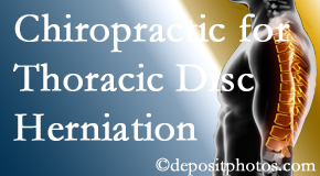 Medical Spine and Sports Injury and Rehab Centers diagnoses and treats thoracic disc herniation pain and relieves its symptoms like unexplained abdominal pain or other gastrointestinal issues. 