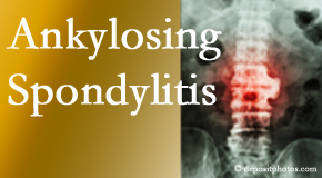 Ankylosing spondylitis is gently cared for by your Baton Rouge  chiropractor.