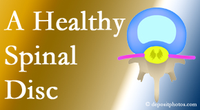 Your Baton Rouge  chiropractor loves seeing a healthy intervertebral disc and helps the not so healthy one recover.