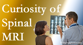 Baton Rouge  MRIs for spinal stenosis may be revealing…or puzzling.