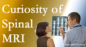 Baton Rouge MRIs for spinal stenosis may be revealing…or puzzling.