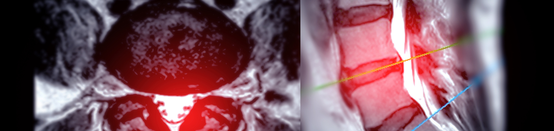 Baton Rouge back pain imaging and exercise