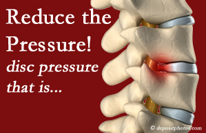 picture of Baton Rouge disc herniation