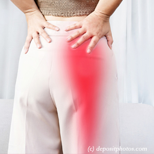 image of Baton Rouge leg pain, sciatica, lumbar radiculopathy