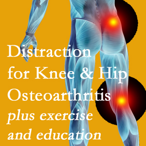 A chiropractic treatment plan for Baton Rouge  knee pain and hip pain caused by osteoarthritis: education, exercise, distraction.