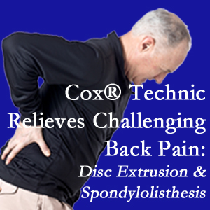 Baton Rouge chiropractic care with Cox Technic alleviates back pain due to a painful combination of a disc extrusion and a spondylolytic spondylolisthesis.